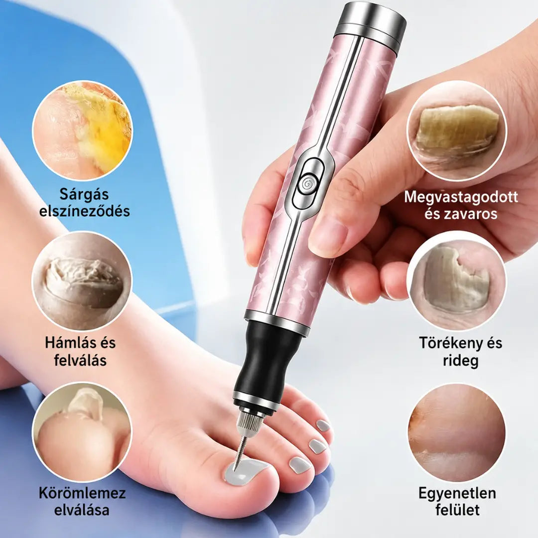 【Korlátozott ideig 50% kedvezmény!】💅👍Elektromos körömreszelő onychomycosis kezelésére