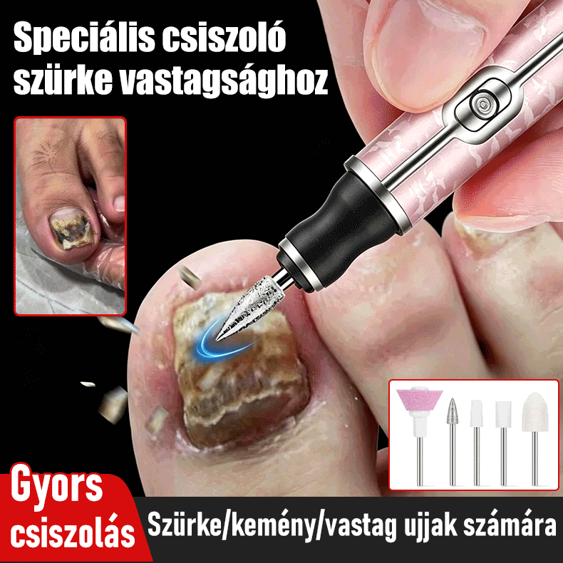 【Korlátozott ideig 50% kedvezmény!】💅👍Elektromos körömreszelő onychomycosis kezelésére